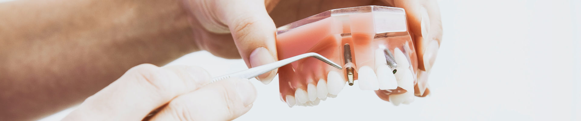 Dental Repair